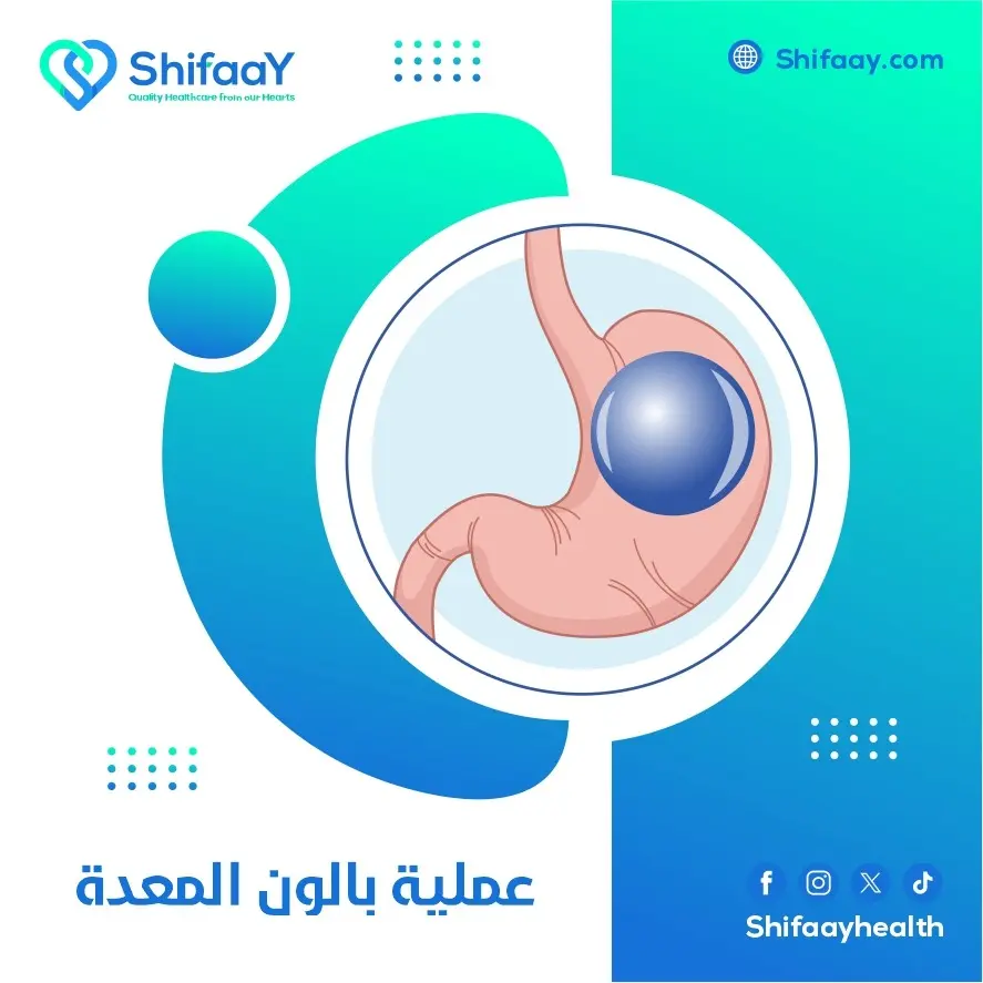 ما هي عملية بالون المعدة 2 عملية بالون المعدة