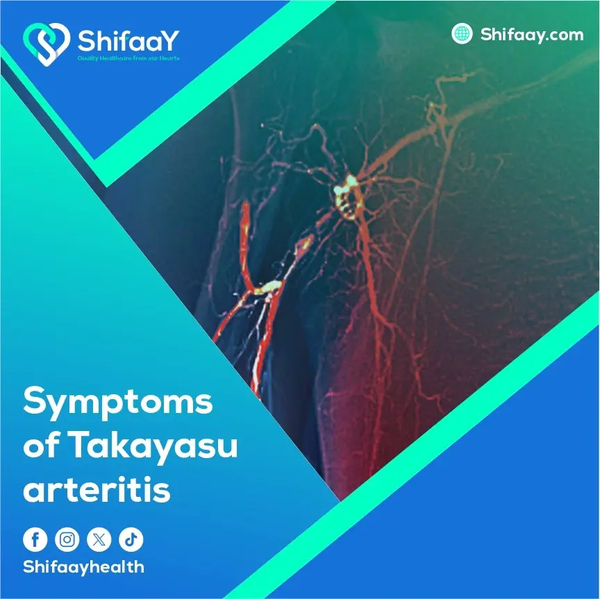 Symptoms of Takayasu Arteritis 2 Symptoms of Takayasu Arteritis