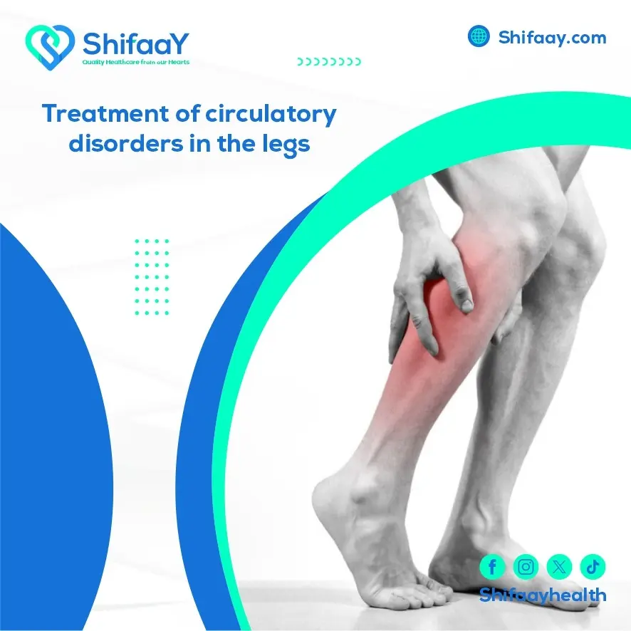 Treatment of Circulatory Disorders in the Legs 1 Circulatory Disorders in the Legs