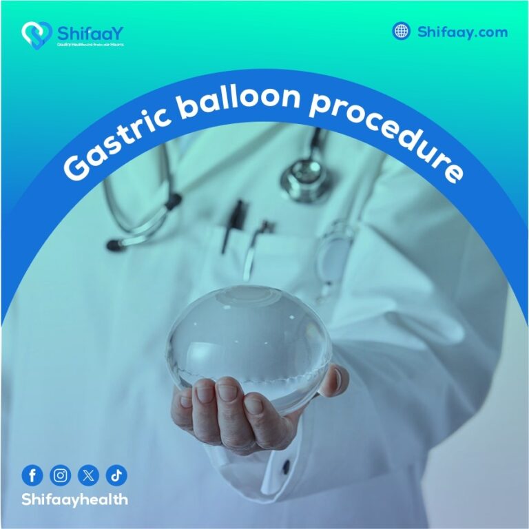 What is the Gastric Balloon Procedure?