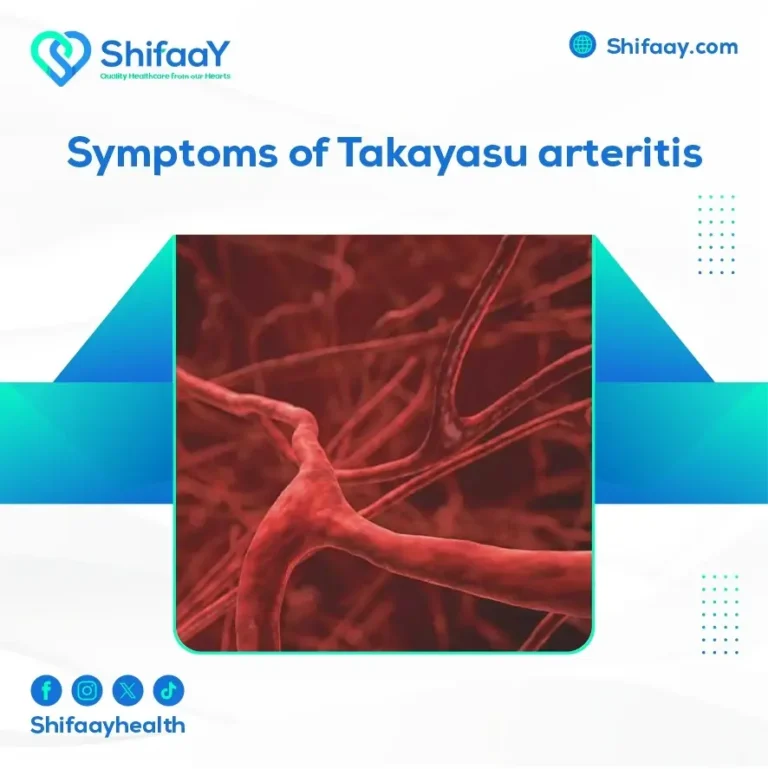Symptoms of Takayasu Arteritis