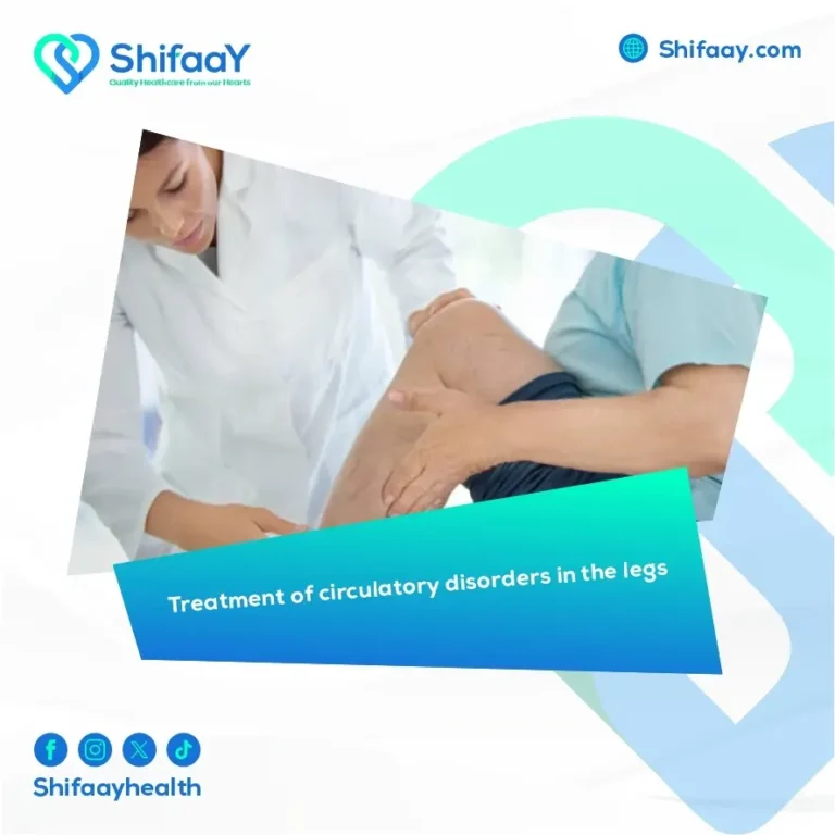 Treatment of Circulatory Disorders in the Legs