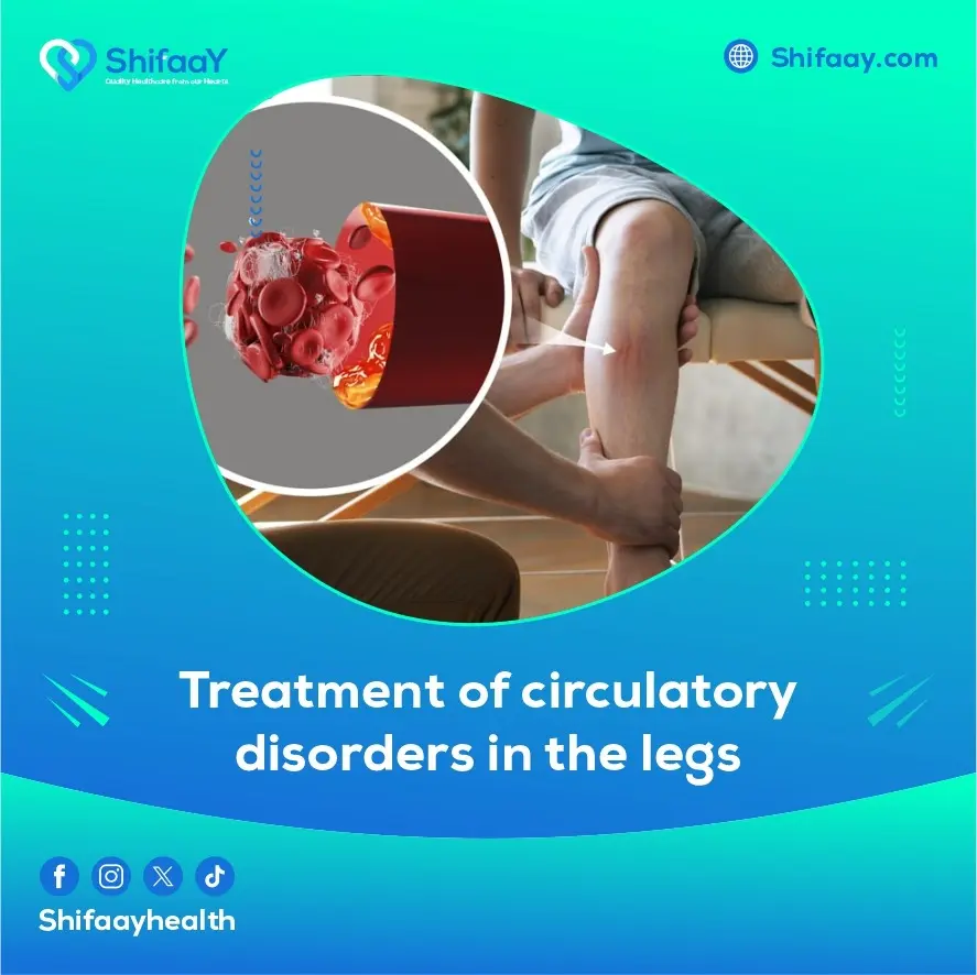 Treatment of Circulatory Disorders in the Legs 2 Circulatory Disorders in the Legs