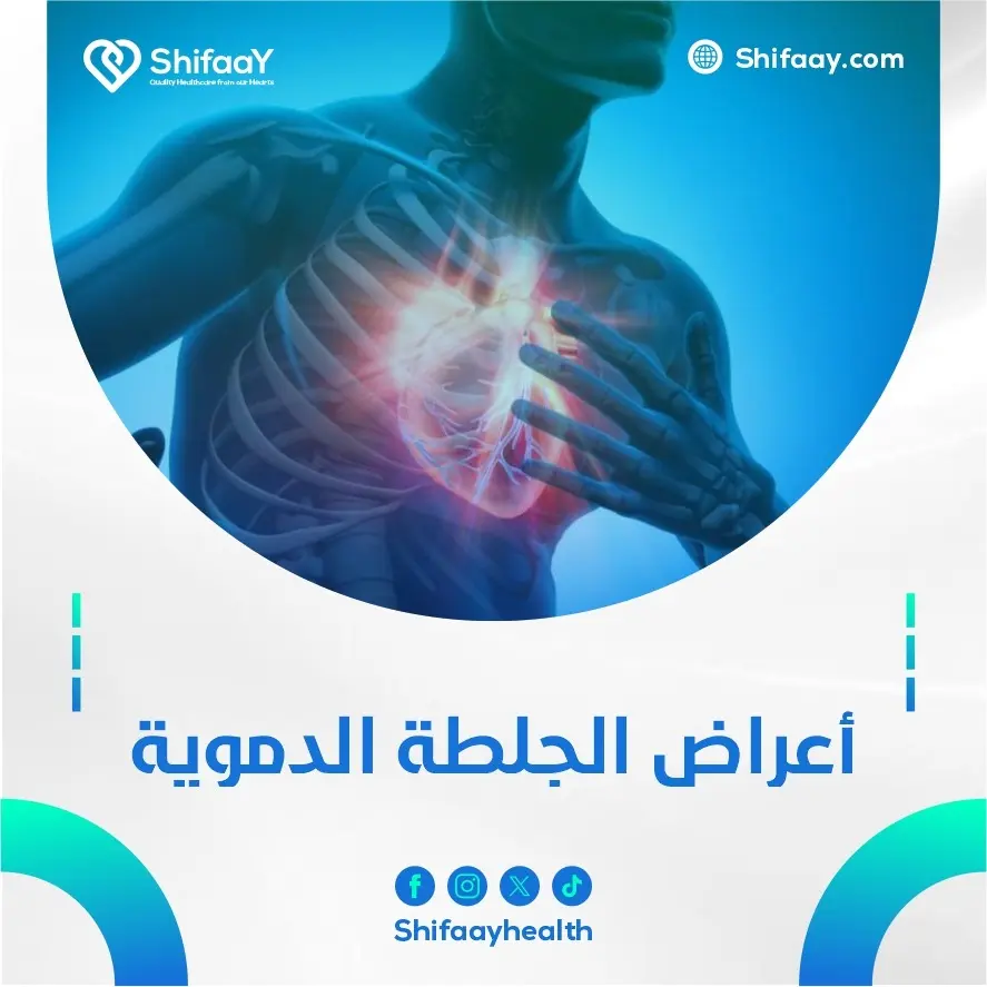 أعراض الجلطة الدموية