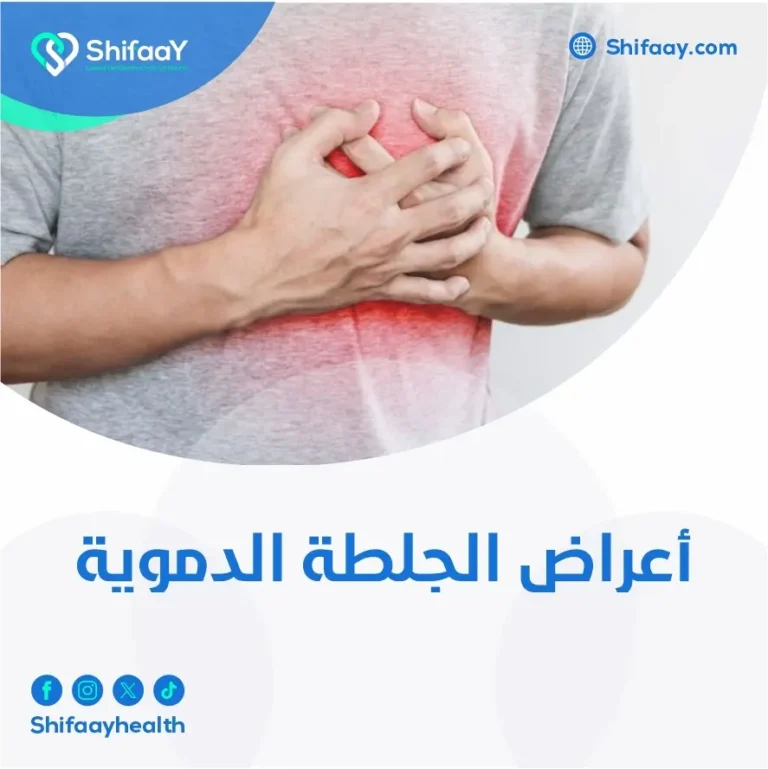 أعراض الجلطة الدموية
