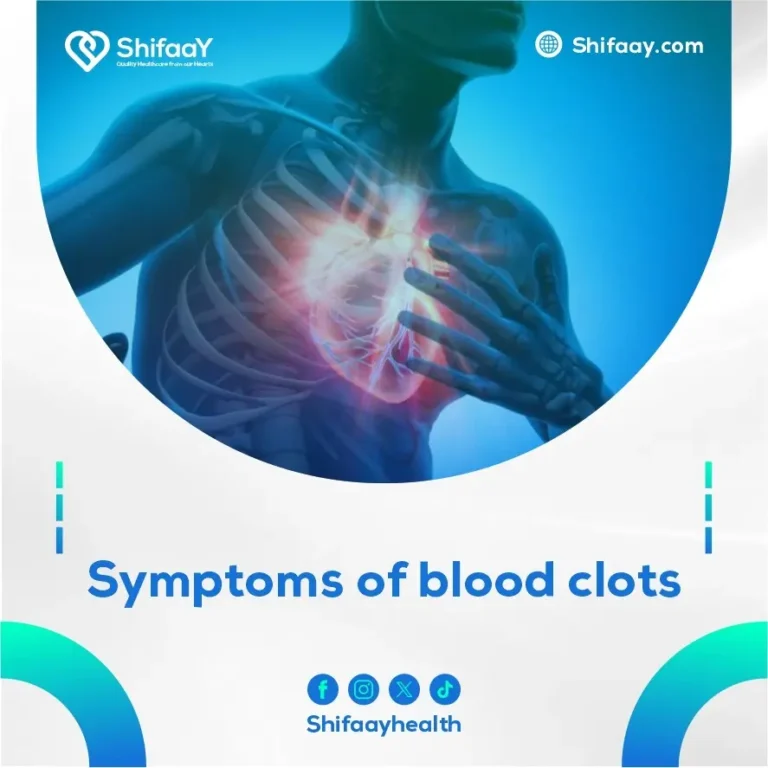 Symptoms of Blood Clots