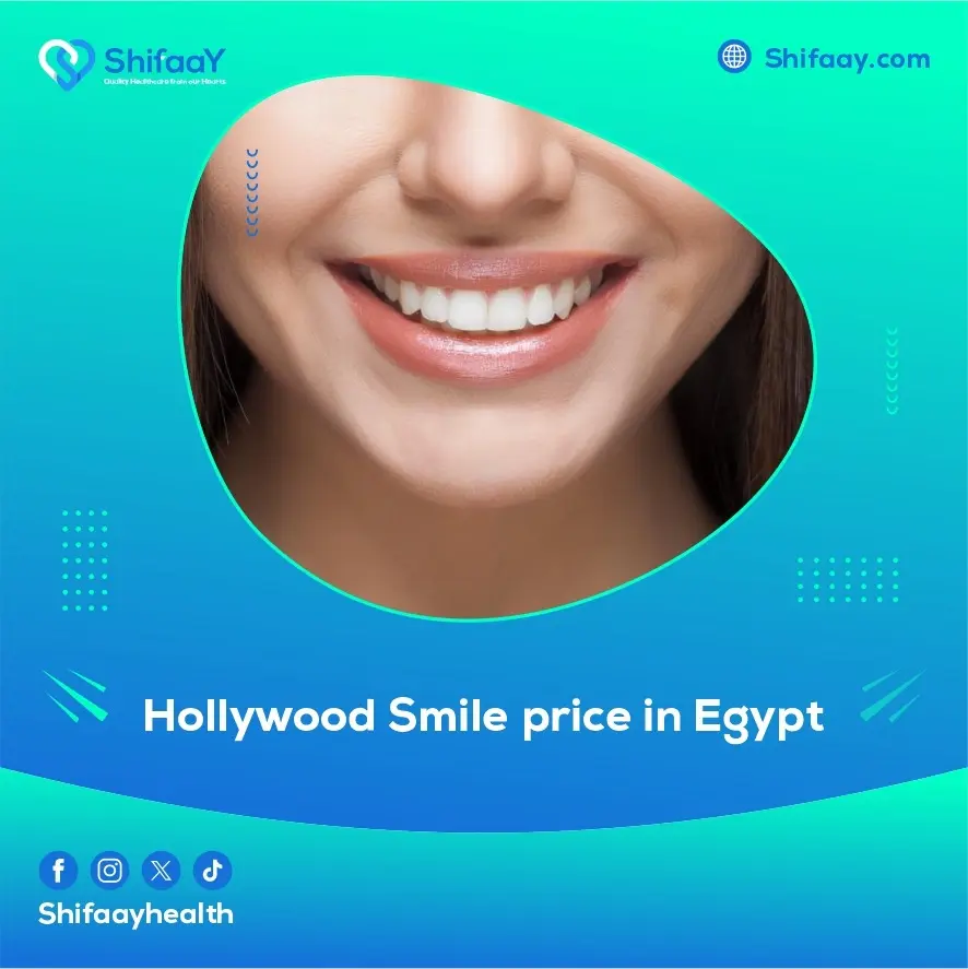 hollywood smile price in egypt