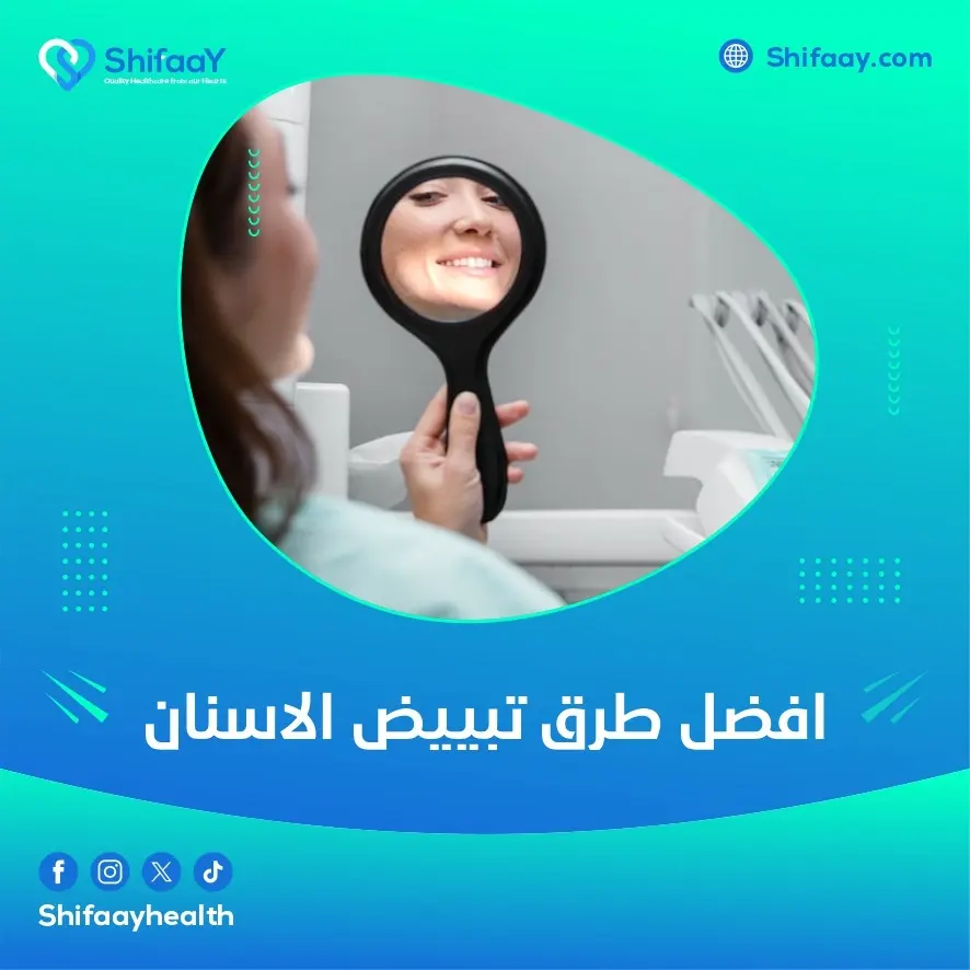 افضل طرق تبييض الاسنان
