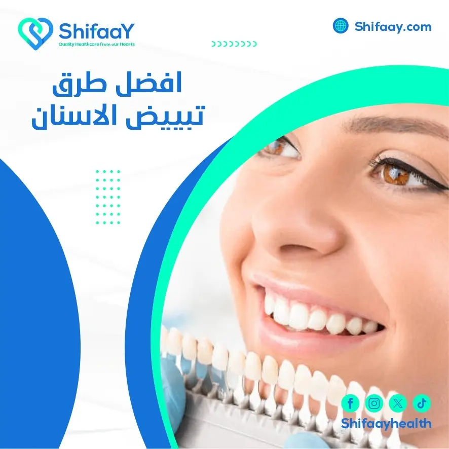 افضل طرق تبييض الاسنان