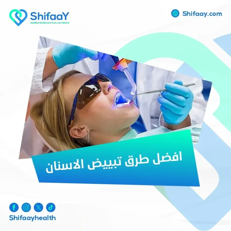 افضل طرق تبييض الاسنان