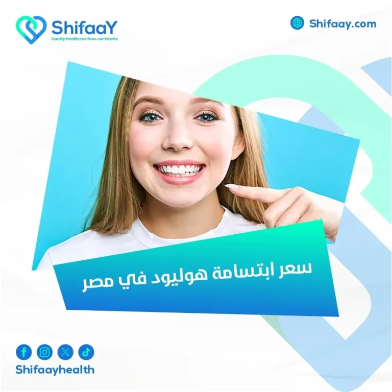 سعر ابتسامة هوليود في مصر