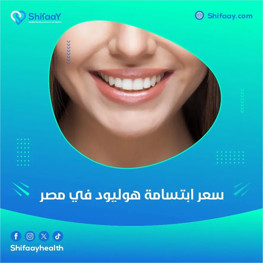 سعر ابتسامة هوليود في مصر