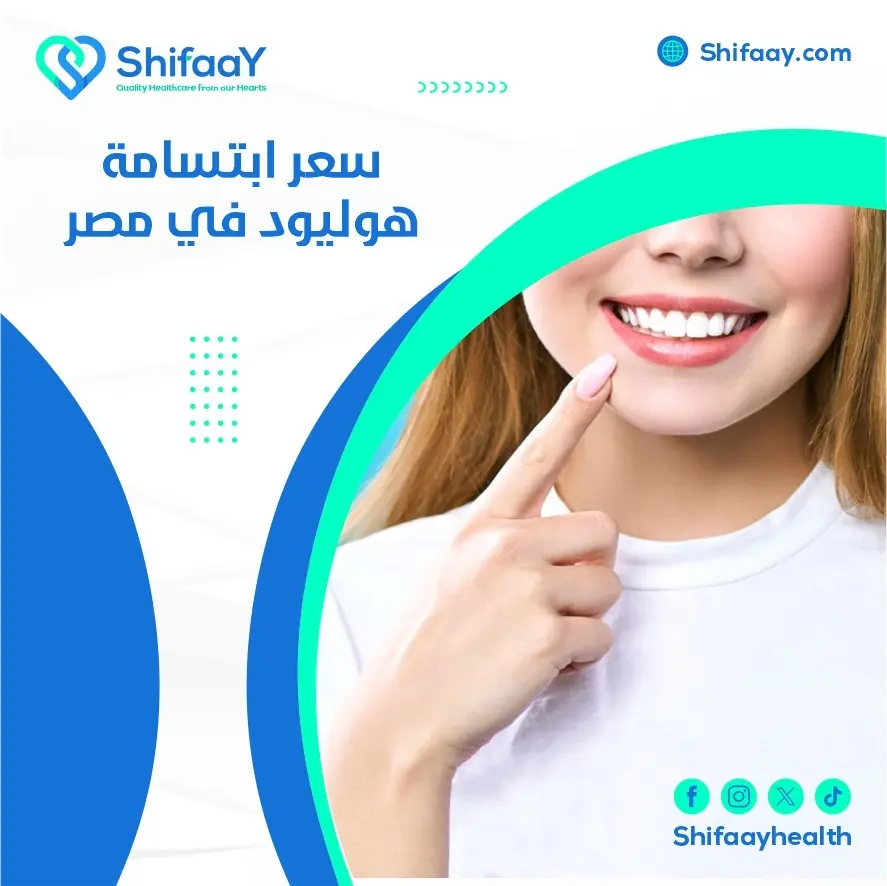 سعر ابتسامه هوليود في مصر