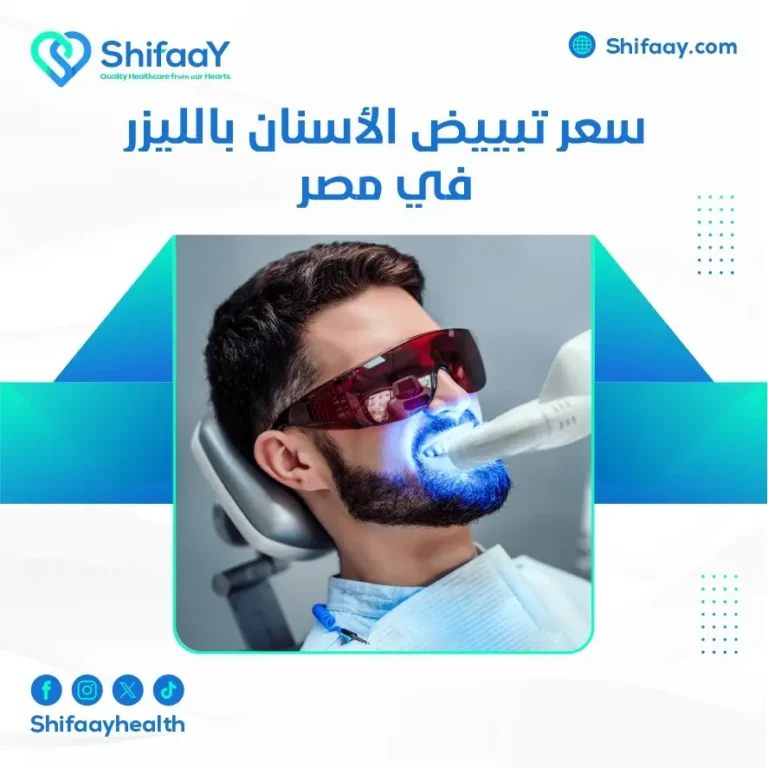 سعر تبييض الأسنان بالليزر في مصر