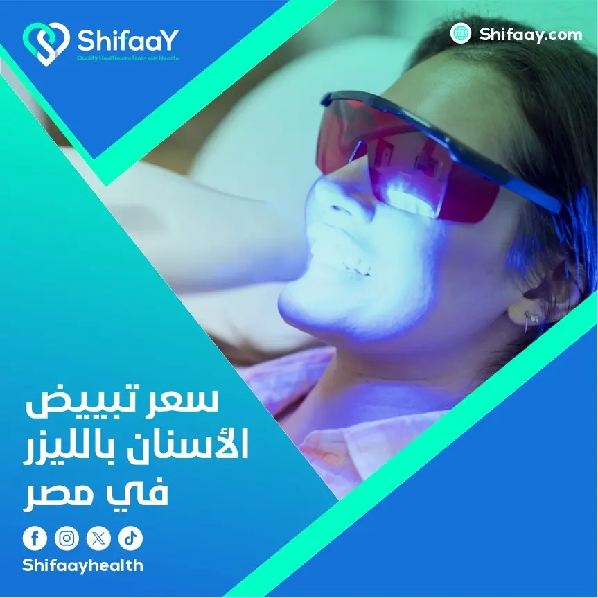 سعر تبييض الأسنان بالليزر في مصر