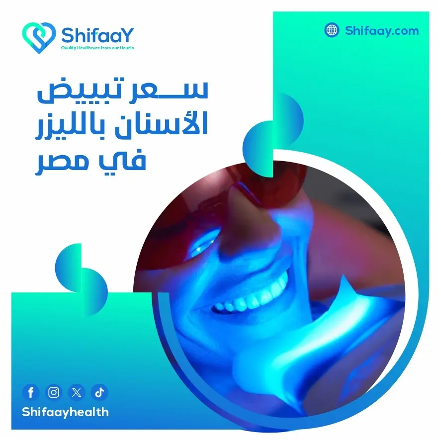 سعر تبييض الأسنان بالليزر في مصر