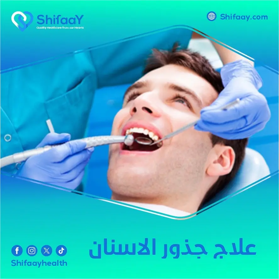 علاج جذور الاسنان 1 علاج جذور الاسنان