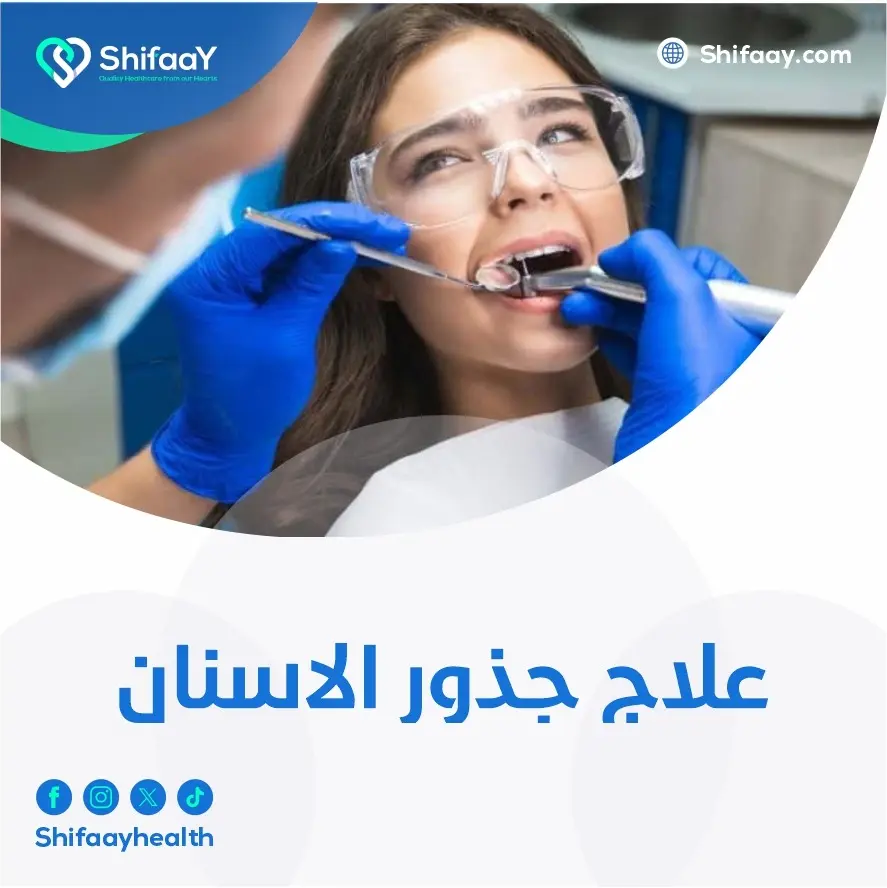 علاج جذور الاسنان 2 علاج جذور الاسنان