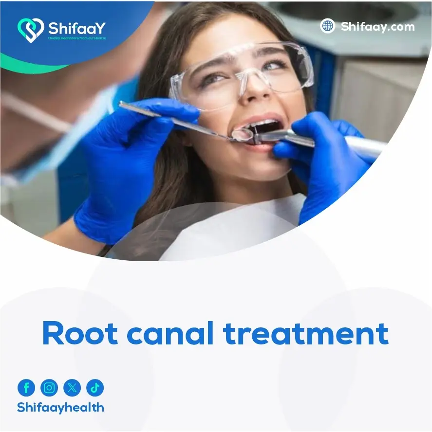 root canal treatment