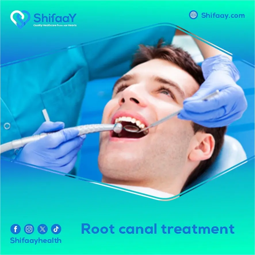 root canal treatment