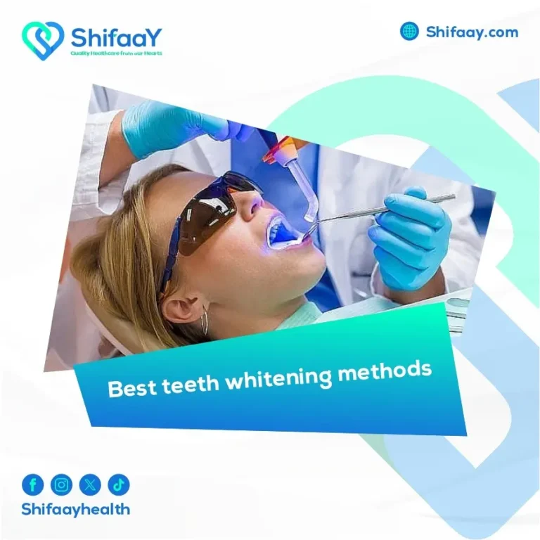 best teeth whitening methods