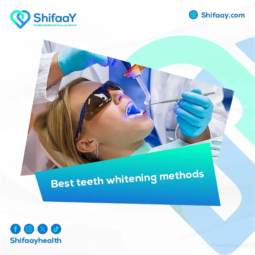 Best Teeth Whitening Methods Shifaay best-teeth-whitening-methods-shifaay