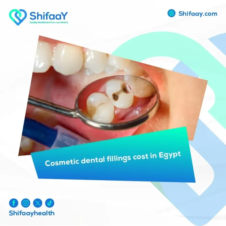 cosmetic dental fillings cost in Egypt