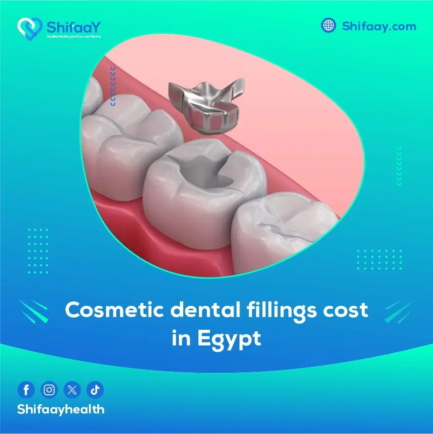 cosmetic dental fillings cost in Egypt