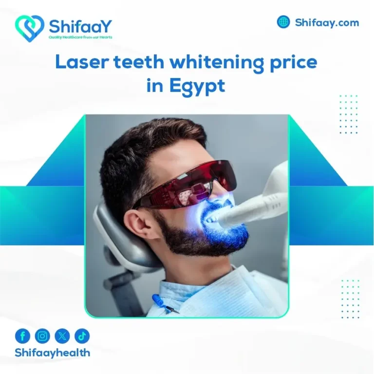 laser teeth whitening price in Egypt 5 laser teeth whitening price in Egypt