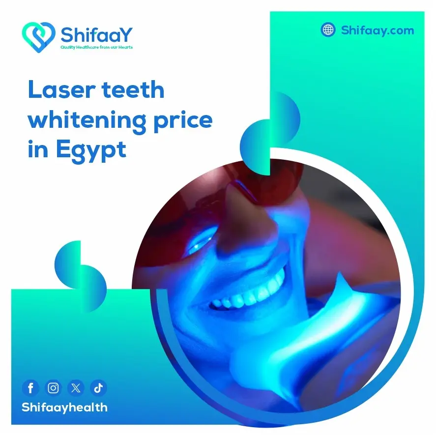 laser teeth whitening price in Egypt 1 laser teeth whitening price in Egypt