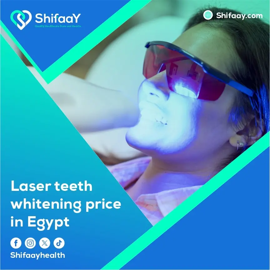 laser teeth whitening price in Egypt 2 laser teeth whitening price in Egypt