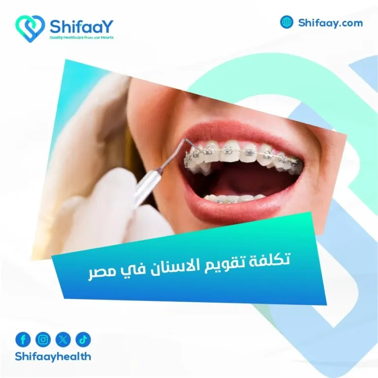 تكلفة تقويم الاسنان في مصر