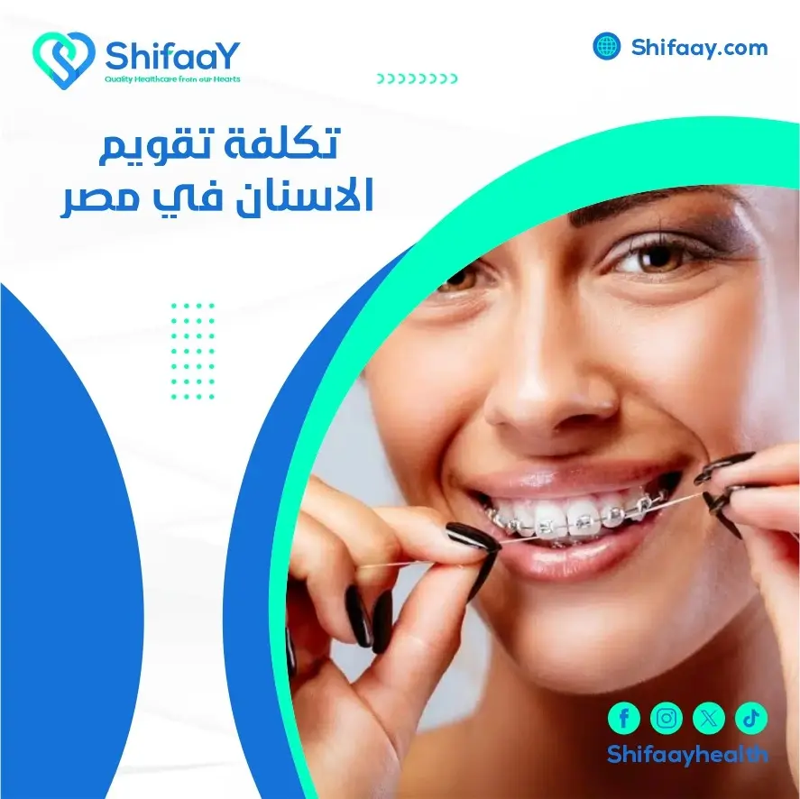 تكلفة تقويم الاسنان في مصر 1 تكلفة تقويم الاسنان في مصر