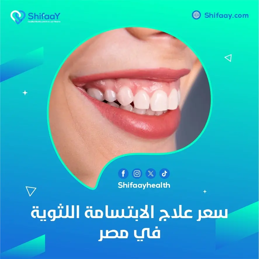سعر علاج الابتسامة اللثوية في مصر 1 علاج الابتسامة اللثوية