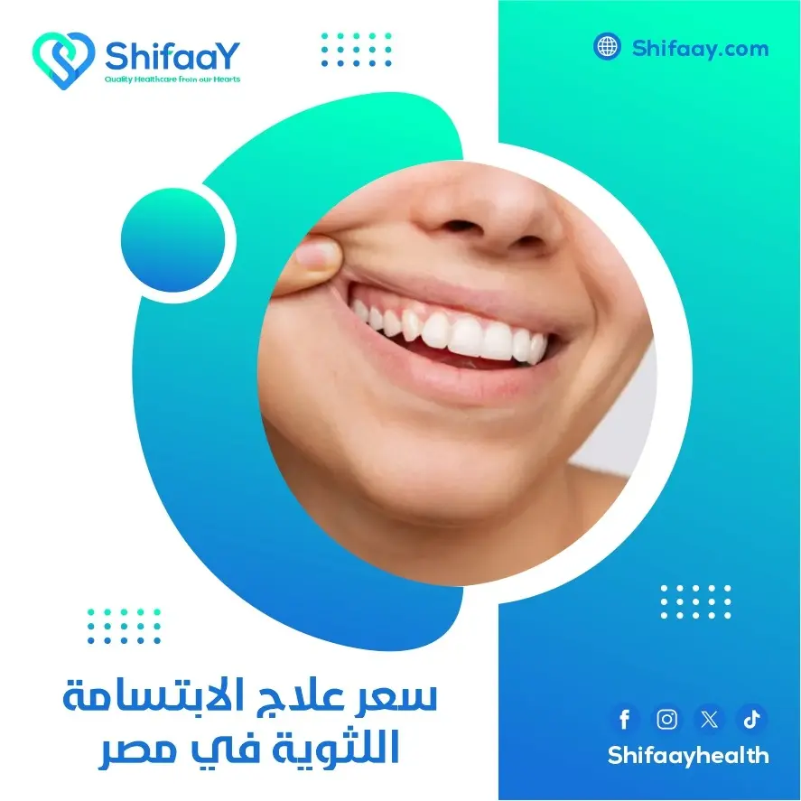 سعر علاج الابتسامة اللثوية في مصر 2 علاج الابتسامة اللثوية