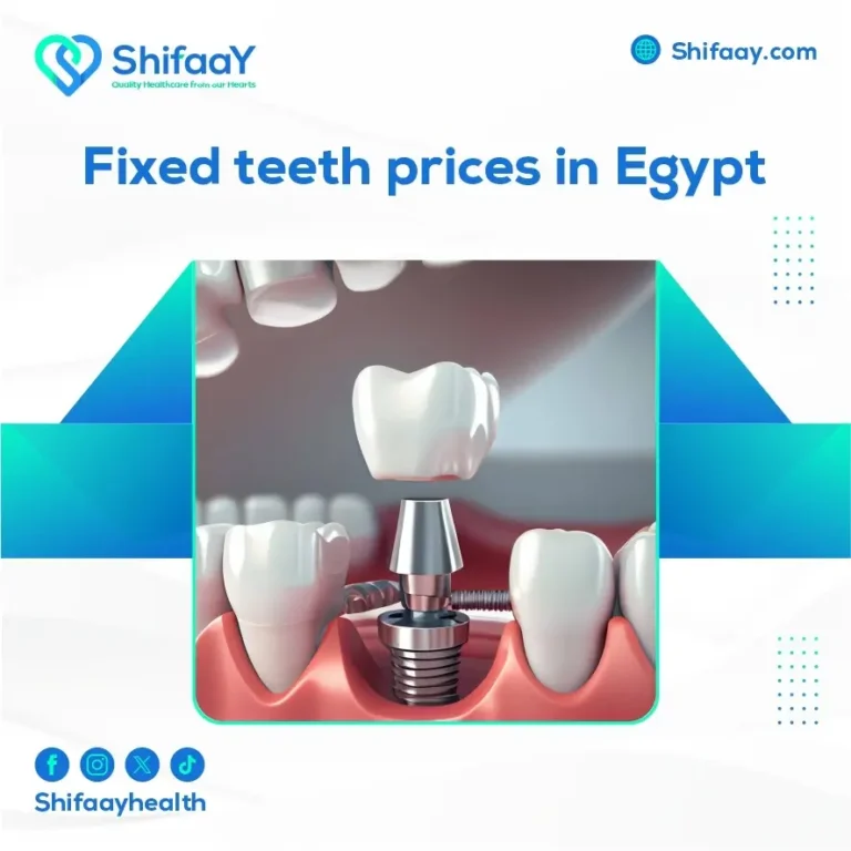 Fixed Teeth Prices in Egypt