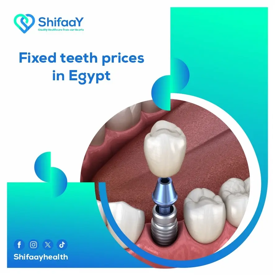 Fixed Teeth Prices in Egypt
