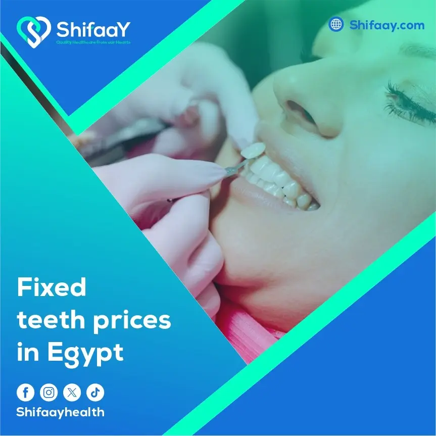 Fixed Teeth Prices in Egypt