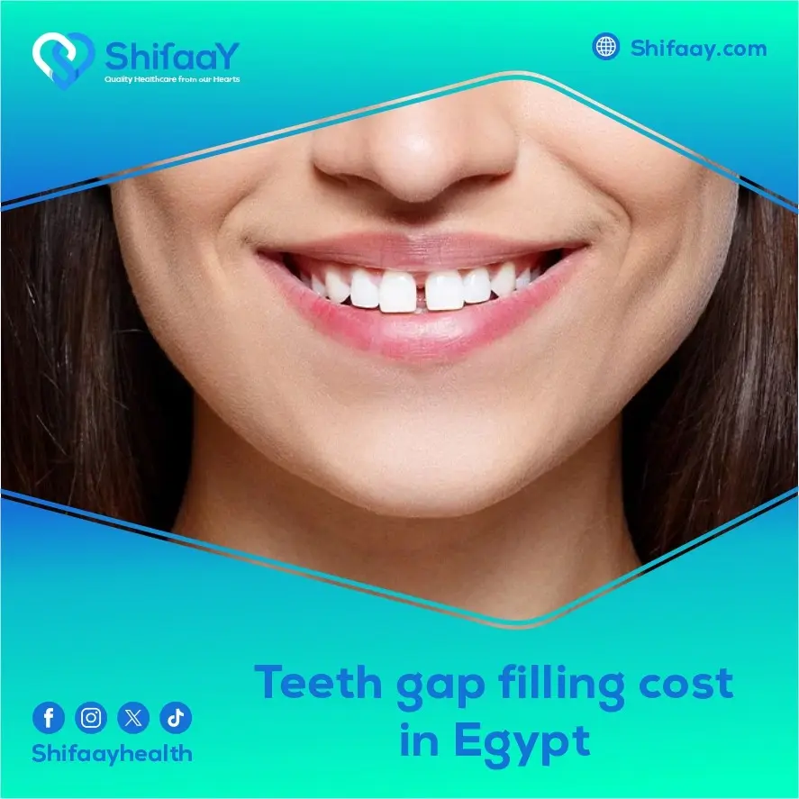 Teeth Gap Filling Cost in Egypt