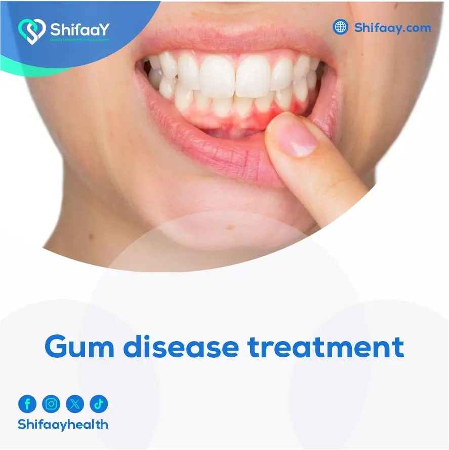 Gum Disease Treatment 2 Gum Disease Treatment