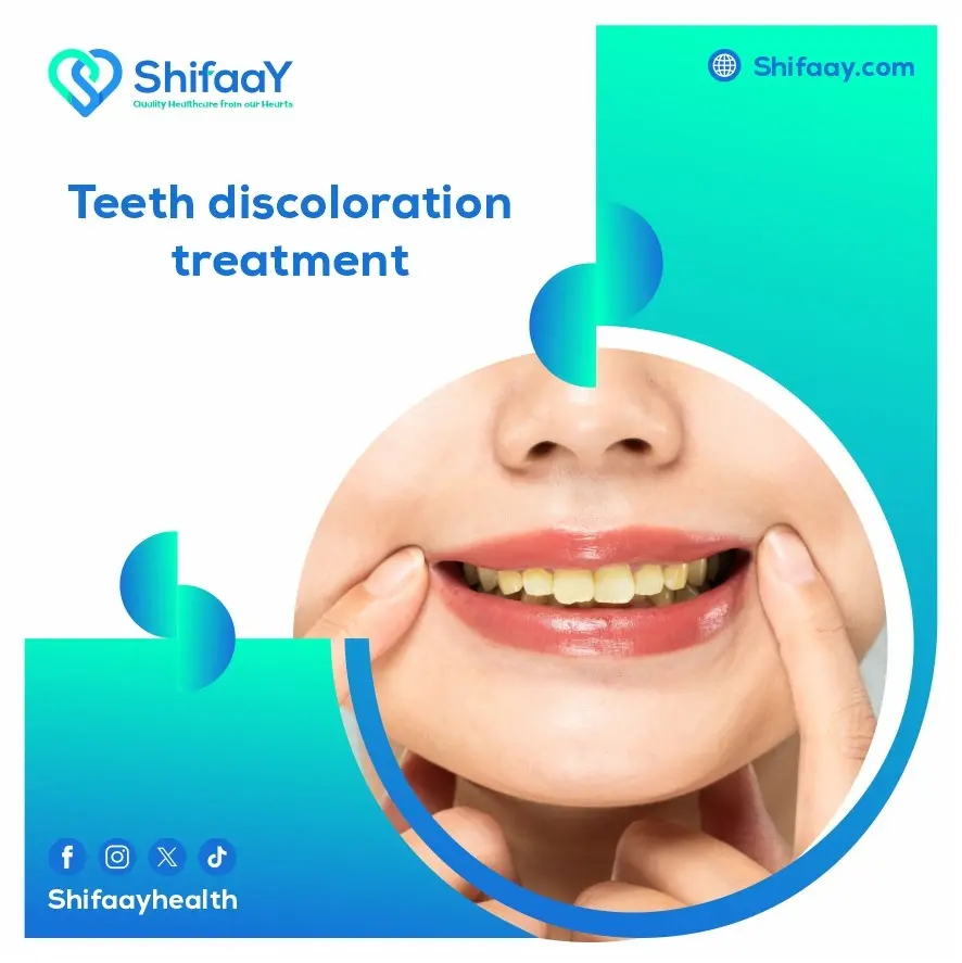 Teeth Discoloration Treatment