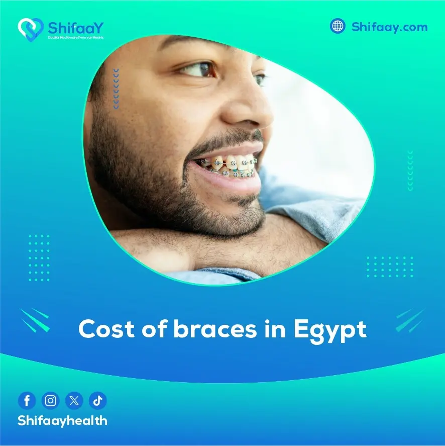braces price in egypt