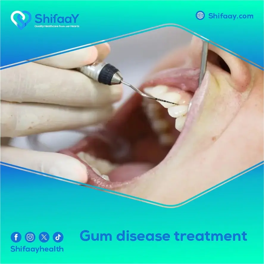 Gum Disease Treatment 1 Gum Disease Treatment