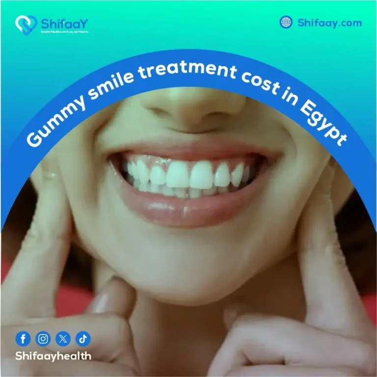 gummy smile treatment cost in Egypt