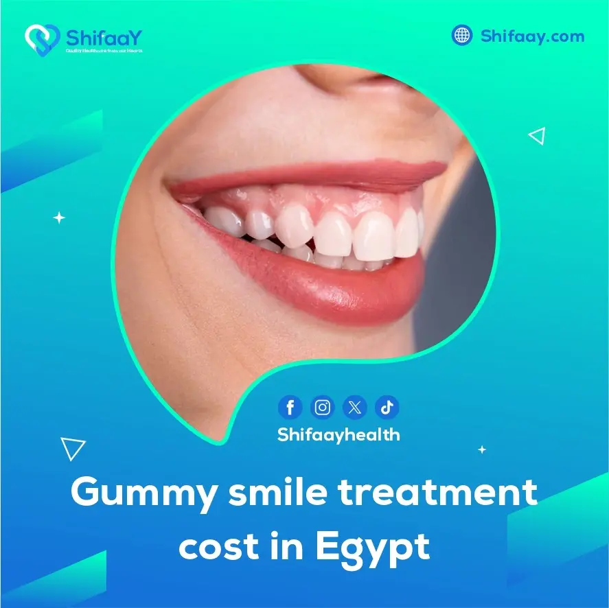 gummy smile treatment cost in Egypt 1 gummy smile treatment cost in Egypt