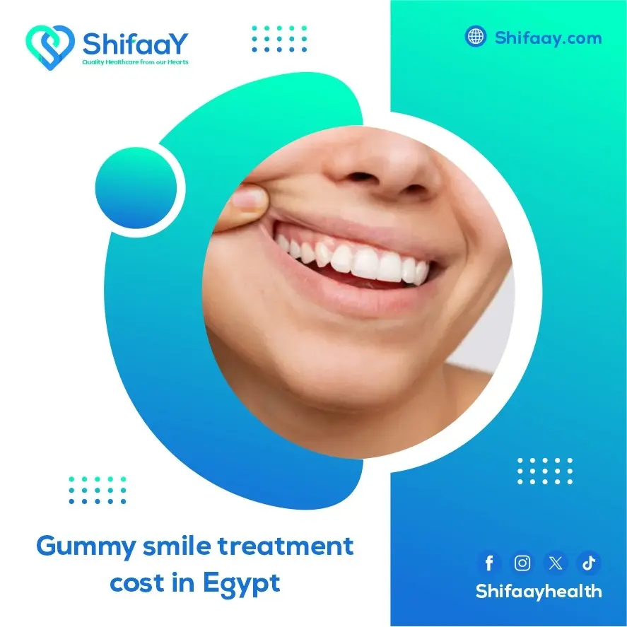 gummy smile treatment cost in Egypt 2 gummy smile treatment cost in Egypt