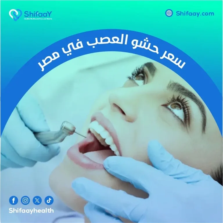 سعر حشو العصب في مصر