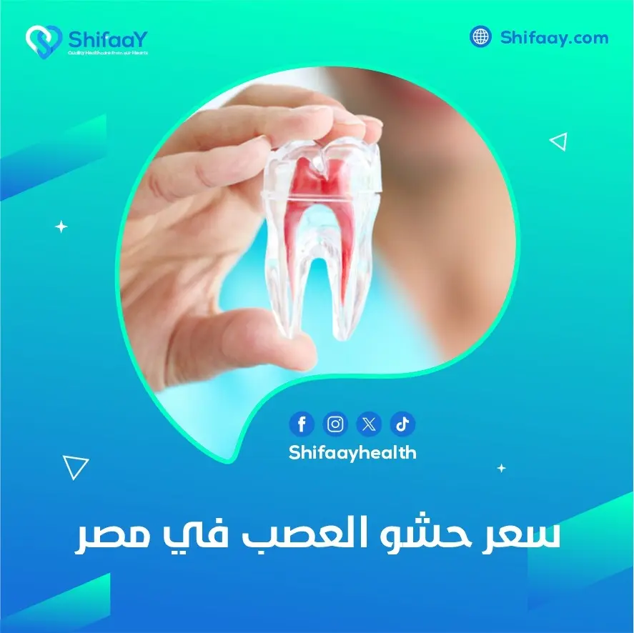 سعر حشو العصب في مصر